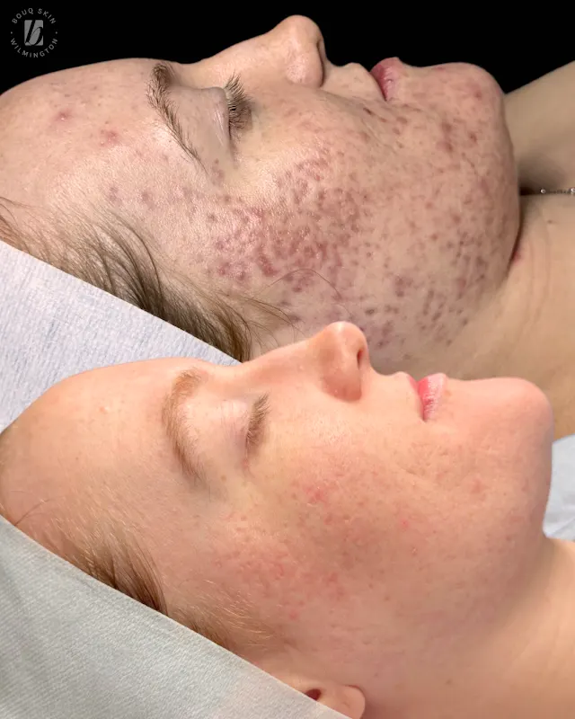 BOUQ Skin — Spa in Wilmington